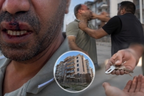 Anahtar Teslimi Sonrası ‘Para İstendi’ İddiası Hastanede Bitti