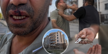 Anahtar Teslimi Sonrası ‘Para İstendi’ İddiası Hastanede Bitti